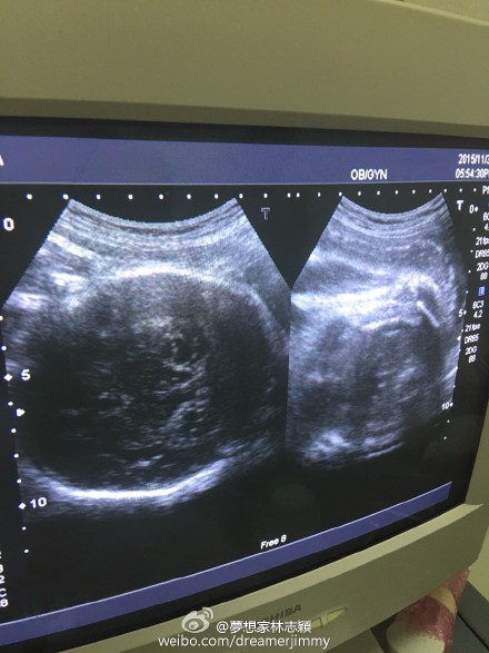 ��־�f���p��̥B����