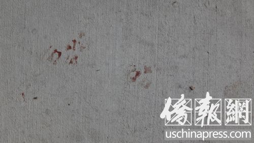 �Tǰˮ�����������Ҋ�׵�Ѫ�E��(�������S��/��� �z)