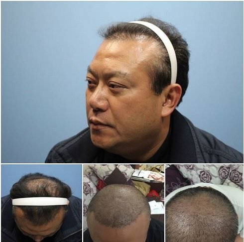 �_���������Q�d�^ֲ�l����Ƭ��W�ѡ����^��