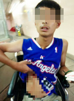 �_�����\�˵����ˏN��2�fԪ���������|ɭ���D��