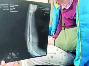 ��܇˾�C�ܽ^���d���˿ʹ�ɹ���