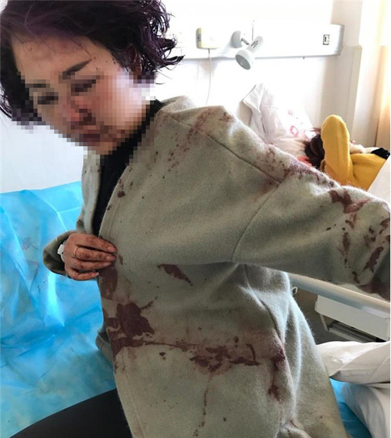 ����Ů��