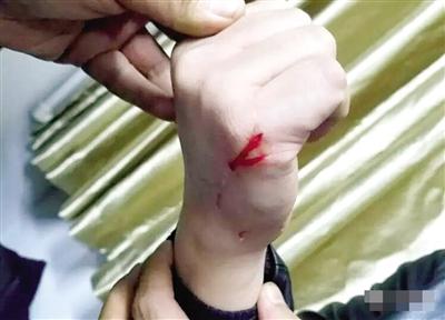 ��(zh��)�з��ٵ��ֱ�ץ��