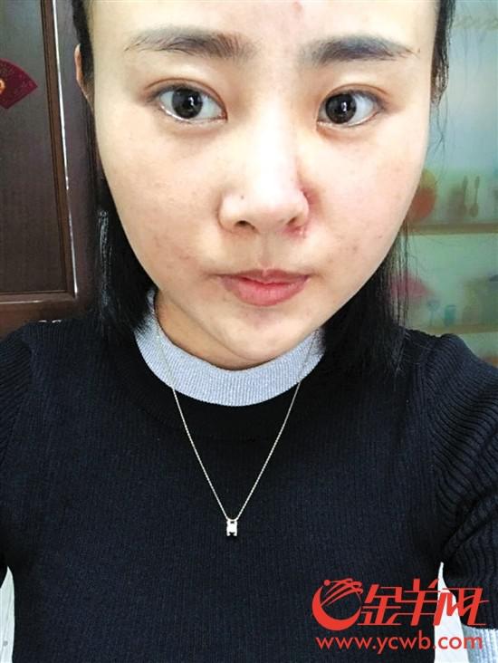 �ܺ��˱���ǰ�󌦱� (�DƬ�ɮ������ṩ��