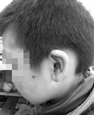 �Ͼ���Ű����ͯ�Q(ch��ng)�����e���򲻹��^ĸ