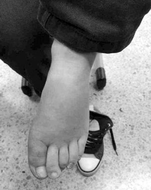 �Ͼ���Ű����ͯ�Q(ch��ng)�����e���򲻹��^ĸ